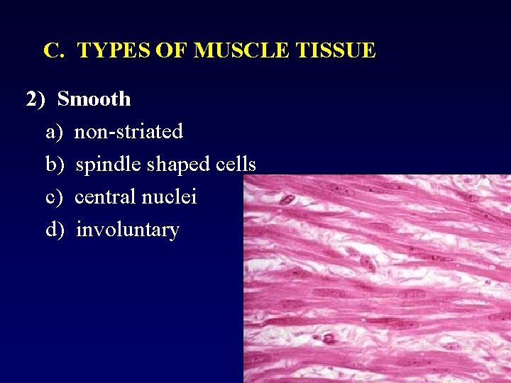 C. TYPES OF MUSCLE TISSUE 2) Smooth a) non-striated b) spindle shaped cells c)