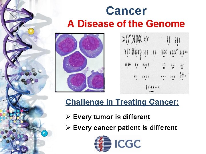 Cancer A Disease of the Genome Challenge in Treating Cancer: Ø Every tumor is