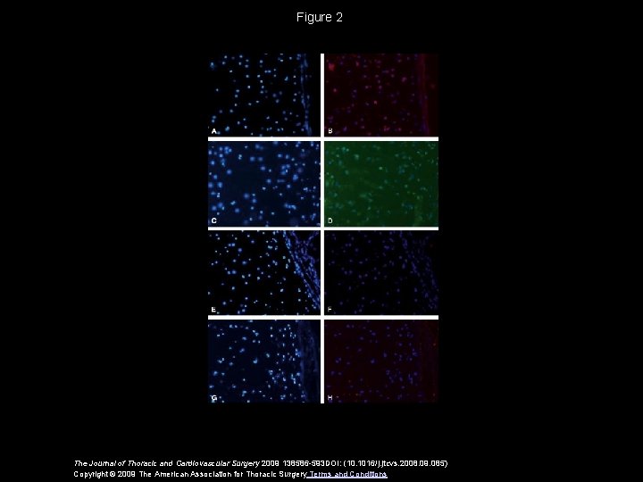 Figure 2 The Journal of Thoracic and Cardiovascular Surgery 2009 138586 -593 DOI: (10.