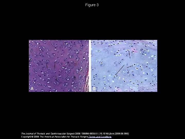 Figure 3 The Journal of Thoracic and Cardiovascular Surgery 2009 138586 -593 DOI: (10.