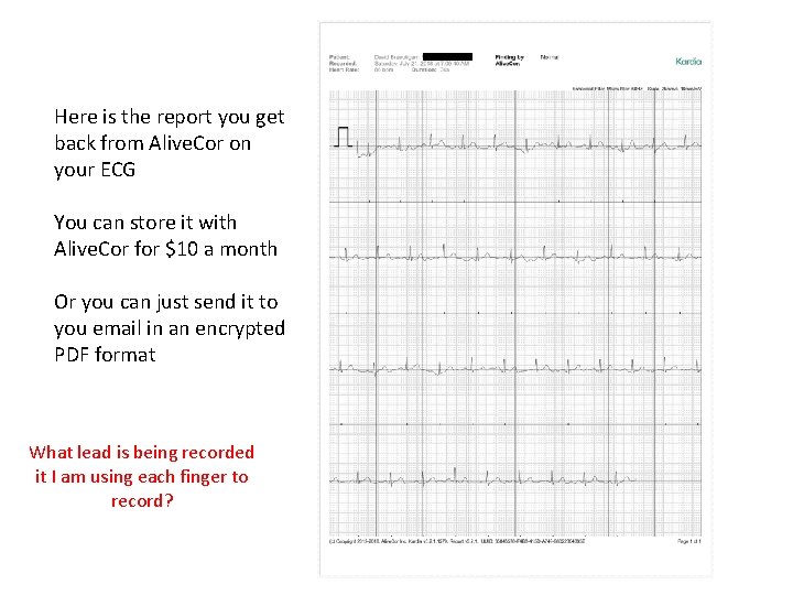 Here is the report you get back from Alive. Cor on your ECG You Here is the report you get back from Alive. Cor on your ECG You