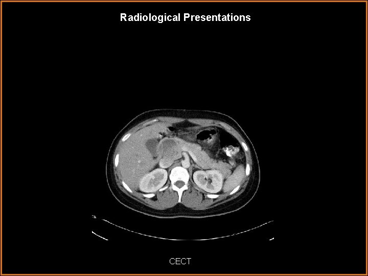 Radiological Presentations CECT 