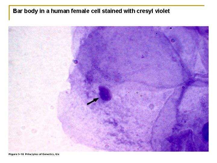 Bar body in a human female cell stained with cresyl violet 