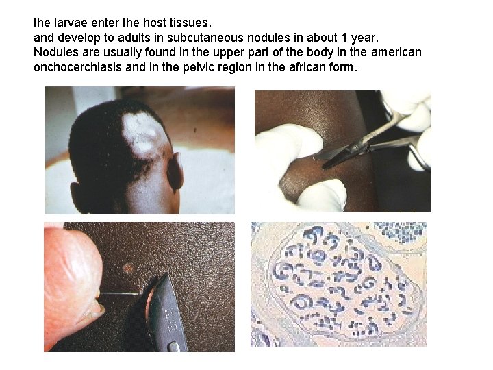 the larvae enter the host tissues, and develop to adults in subcutaneous nodules in