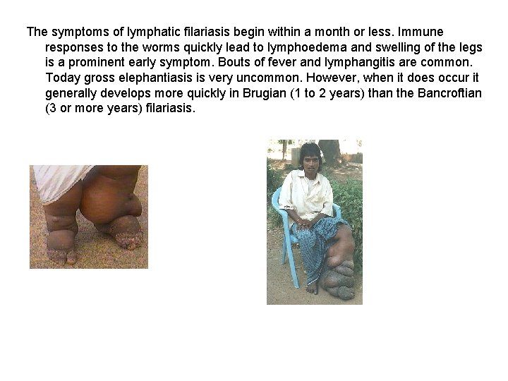 The symptoms of lymphatic filariasis begin within a month or less. Immune responses to