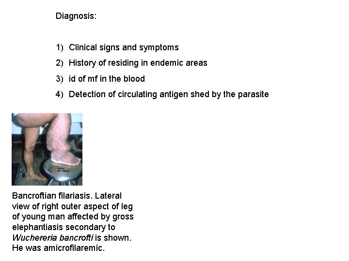 Diagnosis: 1) Clinical signs and symptoms 2) History of residing in endemic areas 3)