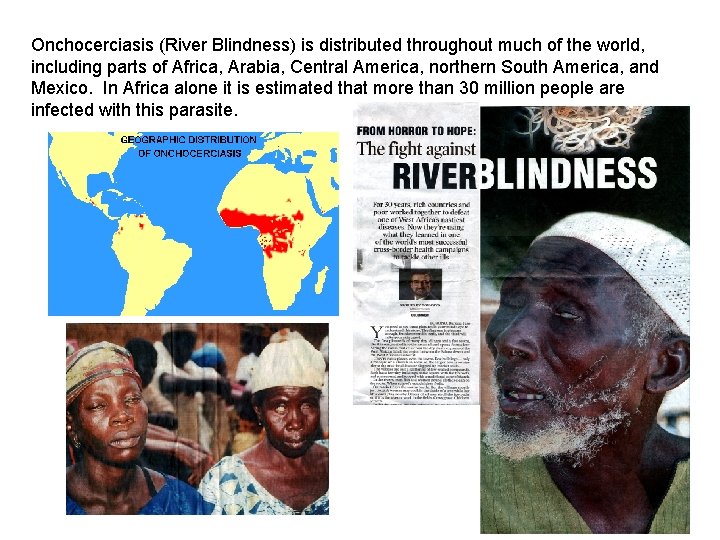 Onchocerciasis (River Blindness) is distributed throughout much of the world, including parts of Africa,