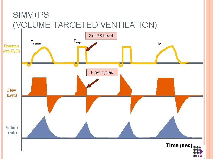 SIMV+PS (VOLUME TARGETED VENTILATION) Set PS Level Pressure (cm H 2 O) Tsynch Tsupp