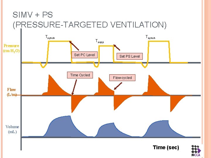 SIMV + PS (PRESSURE-TARGETED VENTILATION) Tsynch Pressure (cm H 2 O) Tsynch Tsupp Set
