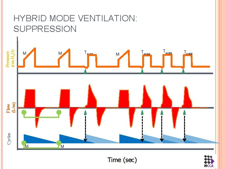 M M Tsupp M Cycles Flow (L/m) Pressure (cm H 2 O) HYBRID MODE