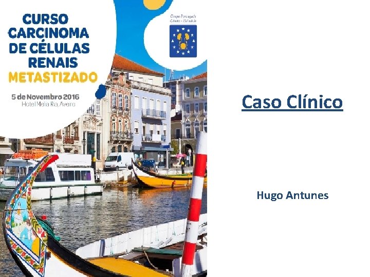 Caso Clínico Hugo Antunes 
