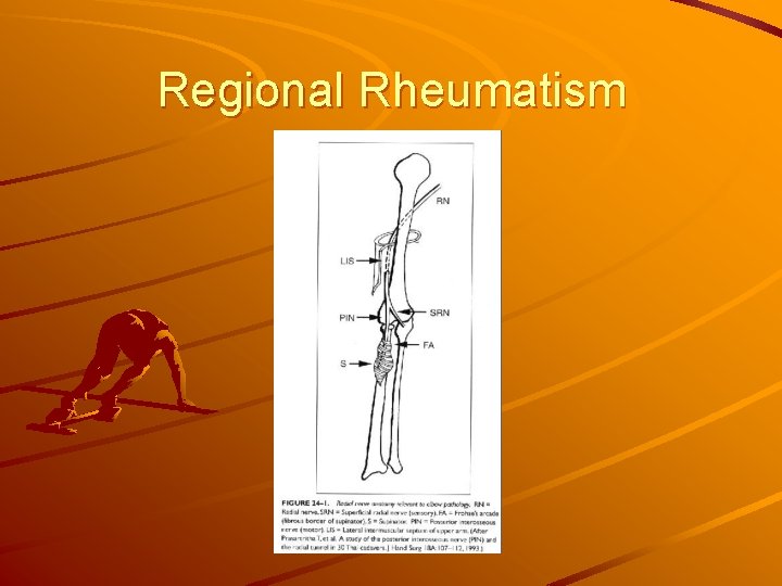 Regional Rheumatism 