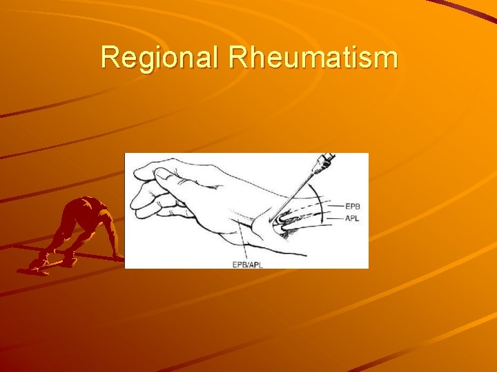 Regional Rheumatism 