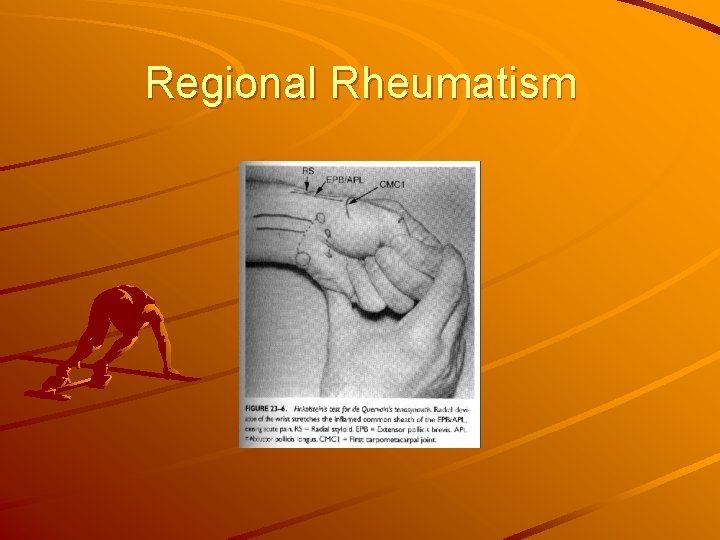 Regional Rheumatism 