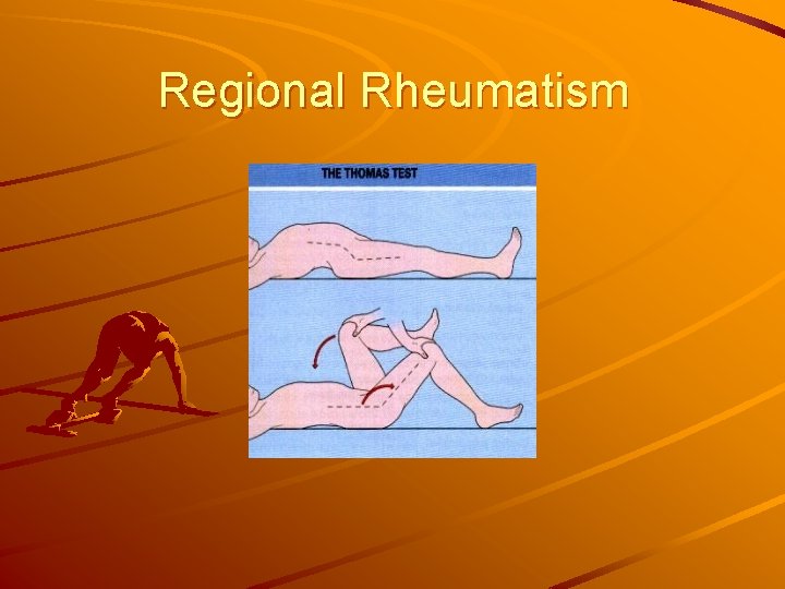 Regional Rheumatism 