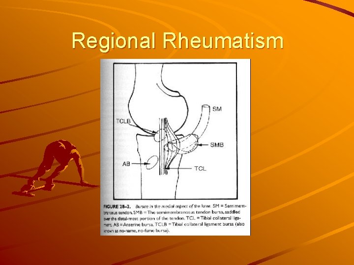 Regional Rheumatism 