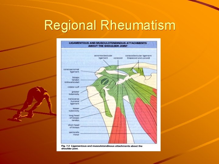 Regional Rheumatism 