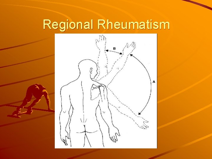 Regional Rheumatism 