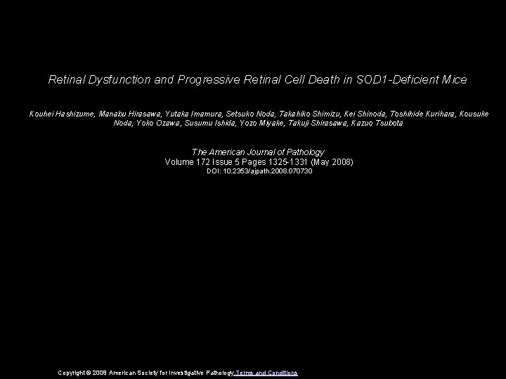 Retinal Dysfunction and Progressive Retinal Cell Death in SOD 1 -Deficient Mice Kouhei Hashizume,