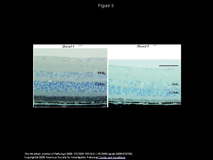 Figure 3 The American Journal of Pathology 2008 1721325 -1331 DOI: (10. 2353/ajpath. 2008.