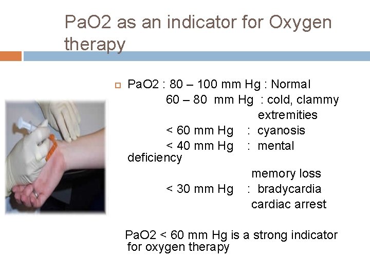 Pa. O 2 as an indicator for Oxygen therapy Pa. O 2 : 80