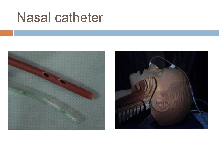 Nasal catheter 