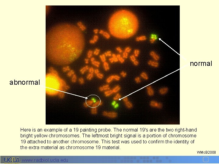 normal abnormal Here is an example of a 19 painting probe. The normal 19's