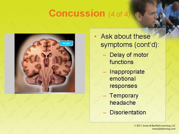 Concussion (4 of 4) • Ask about these symptoms (cont’d): – Delay of motor