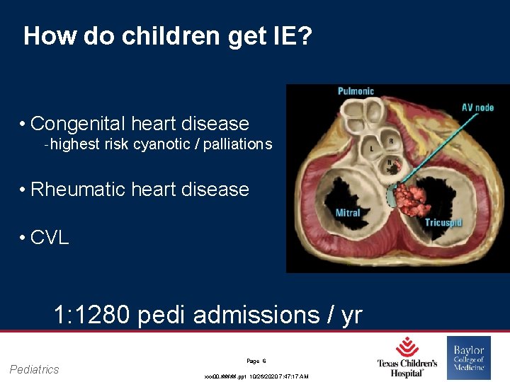 How do children get IE? • Congenital heart disease ‐ highest risk cyanotic / How do children get IE? • Congenital heart disease ‐ highest risk cyanotic /