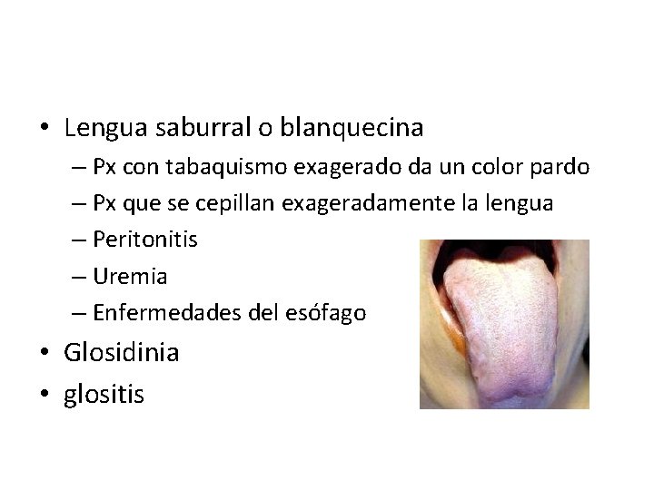  • Lengua saburral o blanquecina – Px con tabaquismo exagerado da un color