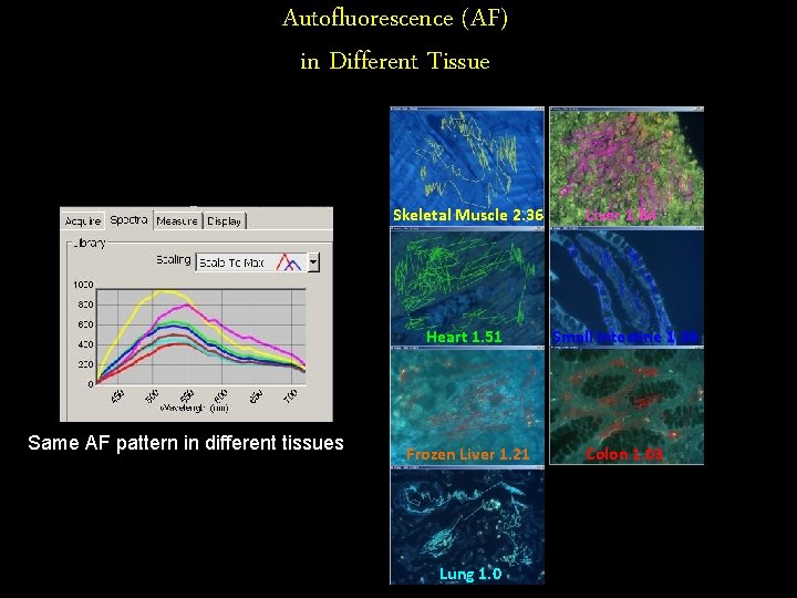 Autofluorescence (AF) in Different Tissue Same AF pattern in different tissues Skeletal Muscle 2.