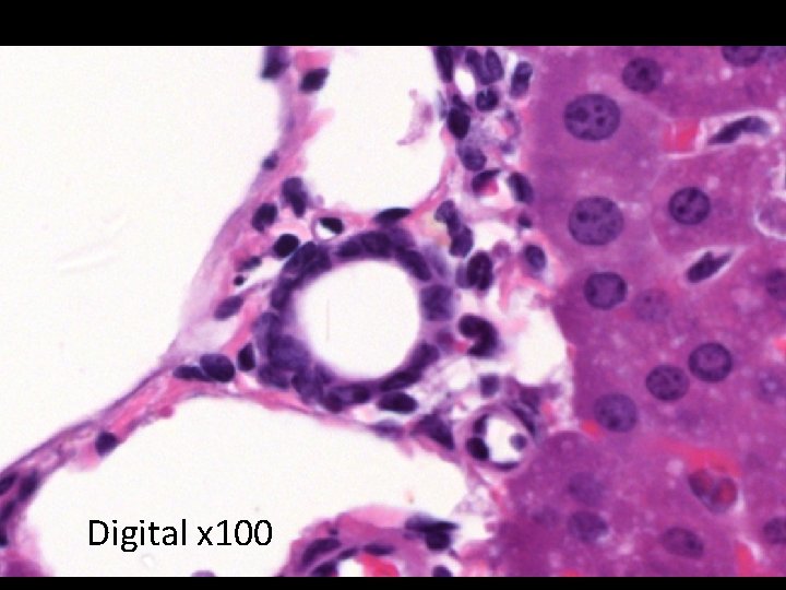 x 40 Digital x 20 Digital x 100 