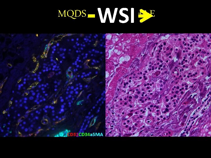 MQDS WSI CD 31 CD 34 a. SMA H&E 