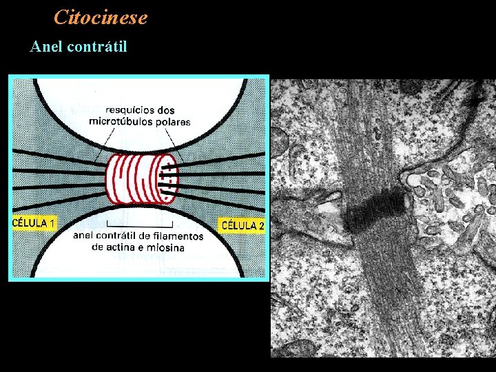 Citocinese Anel contrátil 