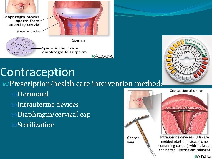 Contraception Prescription/health care intervention methods Hormonal Intrauterine devices Diaphragm/cervical cap Sterilization 