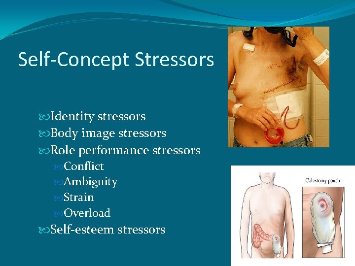 Self-Concept Stressors Identity stressors Body image stressors Role performance stressors Conflict Ambiguity Strain Overload