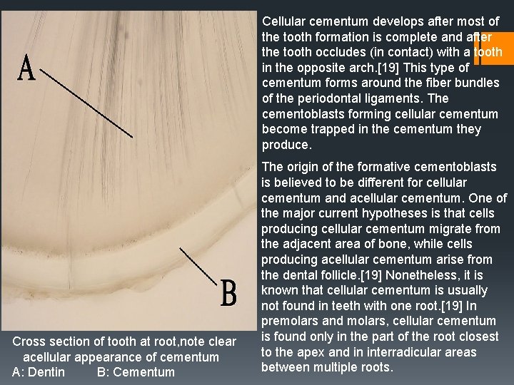 Cellular cementum develops after most of the tooth formation is complete and after the Cellular cementum develops after most of the tooth formation is complete and after the