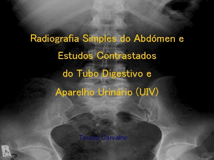 Radiografia Simples do Abdómen e Estudos Contrastados do Tubo Digestivo e Aparelho Urinário (UIV)