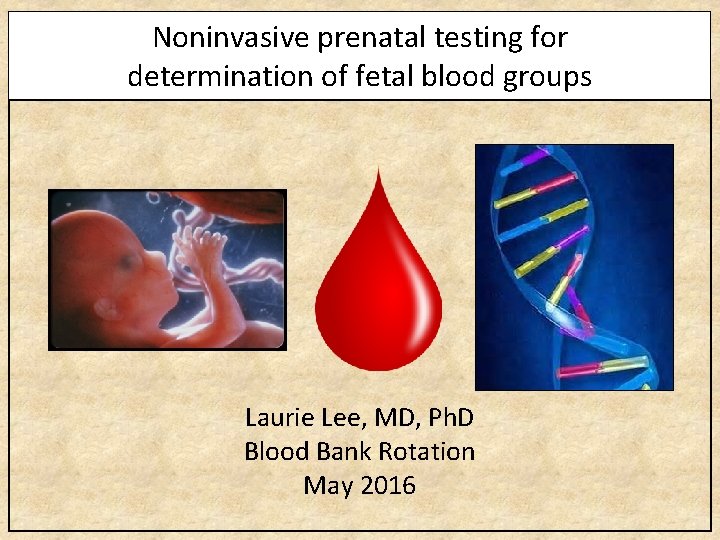 Noninvasive prenatal testing for determination of fetal blood groups Laurie Lee, MD, Ph. D