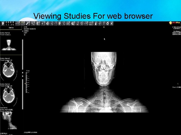 Viewing Studies For web browser 