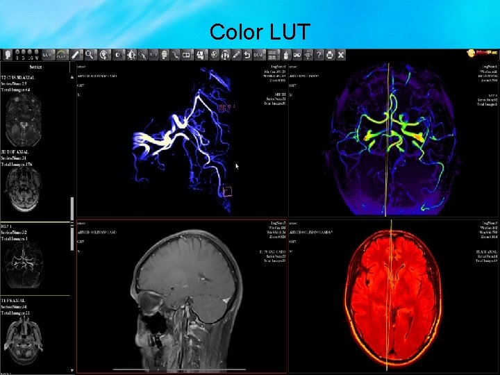 Color LUT 