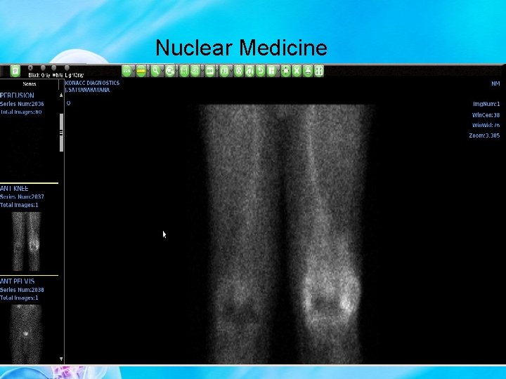 Nuclear Medicine 