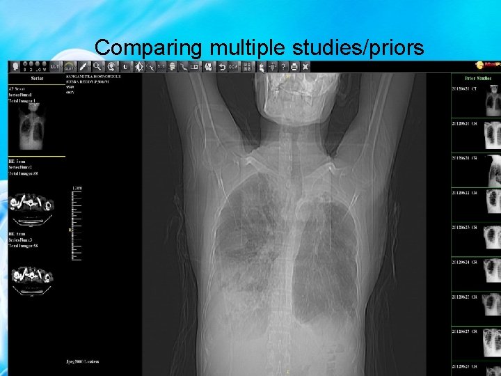 Comparing multiple studies/priors 