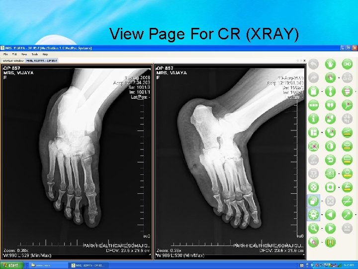 View Page For CR (XRAY) 