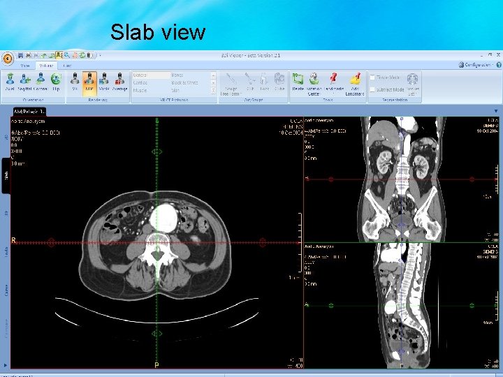 Slab view 