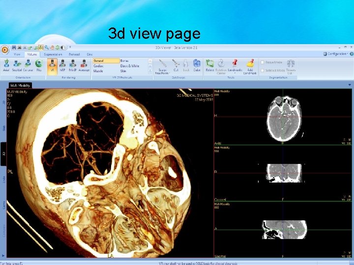 3 d view page 