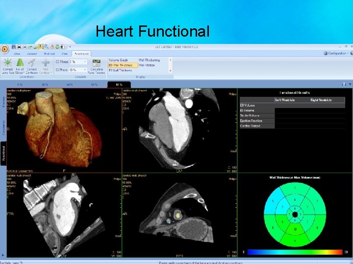 Heart Functional 