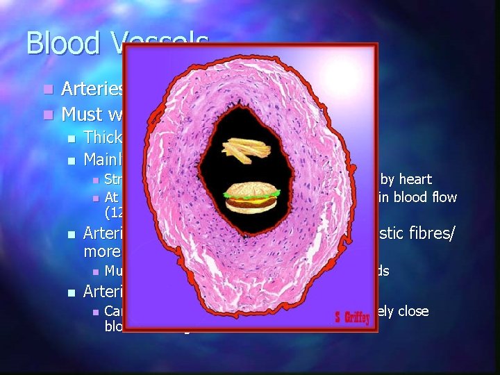 Blood Vessels Arteries n Must withstand high pressure n n n Thick walled Mainly