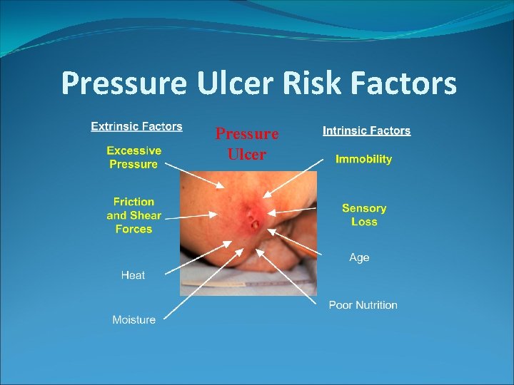 Pressure Ulcer Risk Factors Pressure Ulcer 