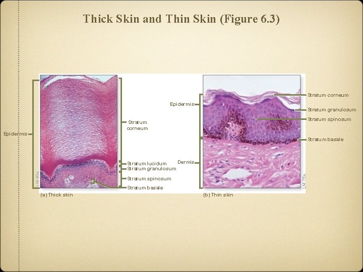 Thick Skin and Thin Skin (Figure 6. 3) Stratum corneum Epidermis Stratum granulosum Stratum